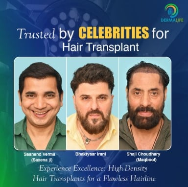 What to Expect at Your First Hair Transplant Consultation: A Step-by-Step Guide